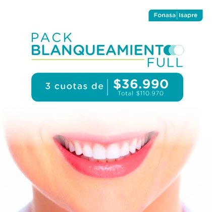 BLANQUEAMIENTO DENTAL