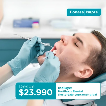 HIGIENE DENTAL