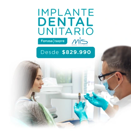 IMPLANTE DENTAL UNITARIO