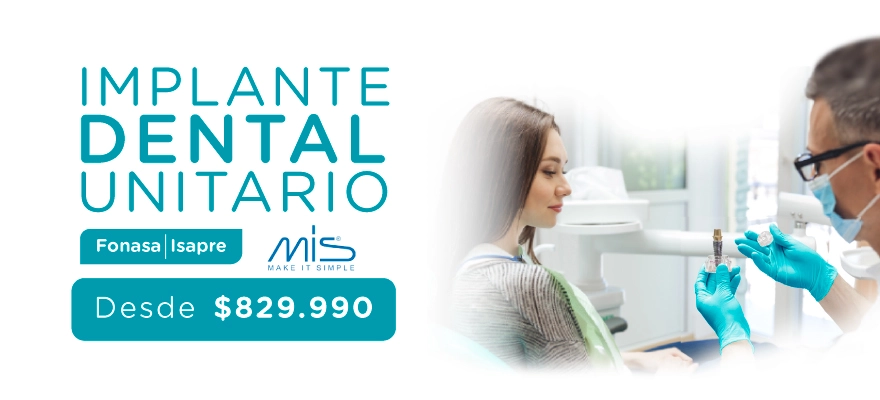 IMPLANTE DENTAL UNITARIO