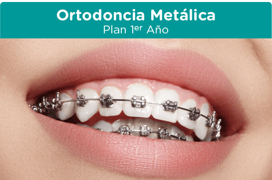 ortodoncia metalica