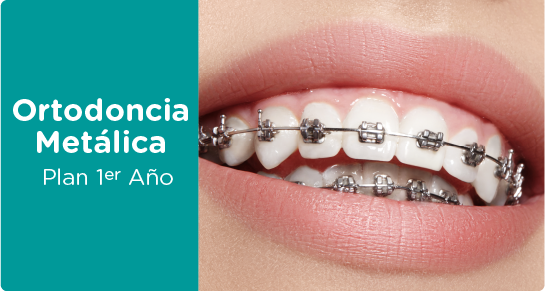 ortodoncia brackets metalicos